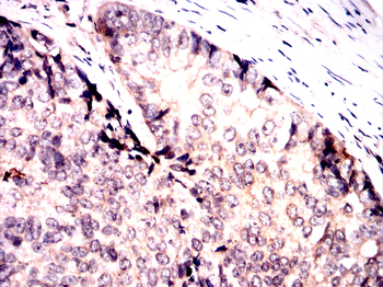 SQSTM1 Antibody