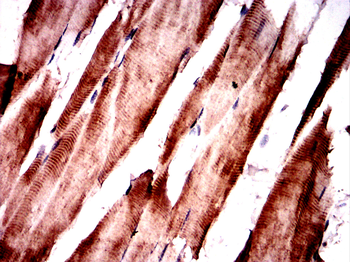 CBL Antibody