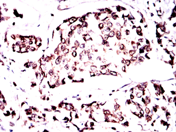 MAP2K7 Antibody