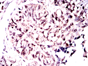 MAP2K7 Antibody