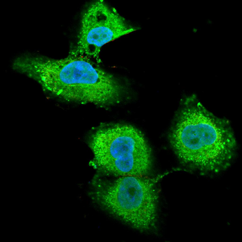 ABCB5 Antibody