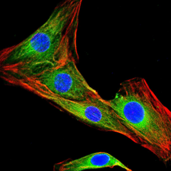 CAMK4 Antibody