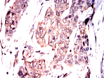 CAMK4 Antibody