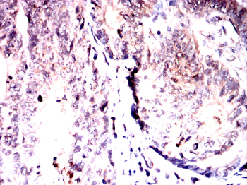 CAMK4 Antibody