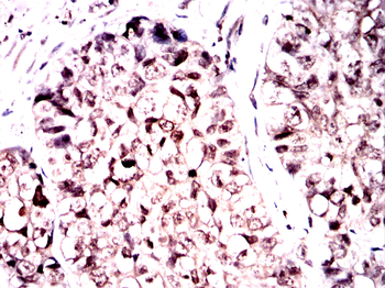 CAMK4 Antibody