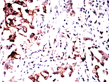 CAMK4 Antibody