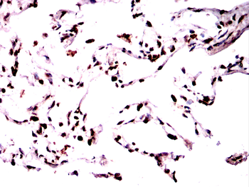 SFTPC Antibody