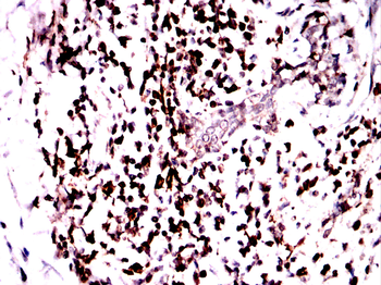 CD74 Antibody