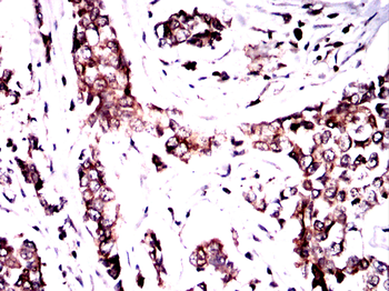 IGFBP7 Antibody