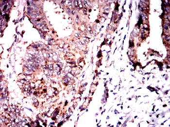 IGFBP7 Antibody