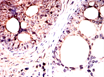 DNAL4 Antibody
