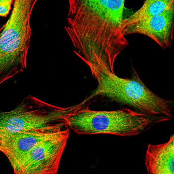 ITGA2B Antibody