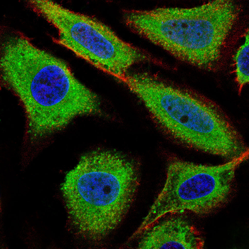 TGFBR3 Antibody