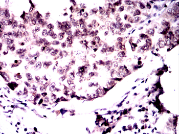 TRAFD1 Antibody