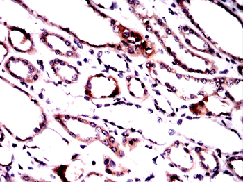 TRAFD1 Antibody