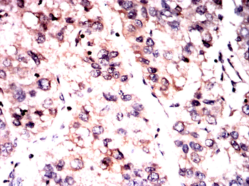 TRAFD1 Antibody