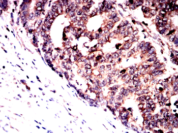 B2M Antibody