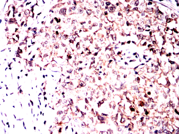 B2M Antibody