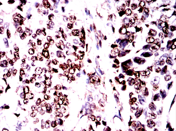 TERF2 Antibody