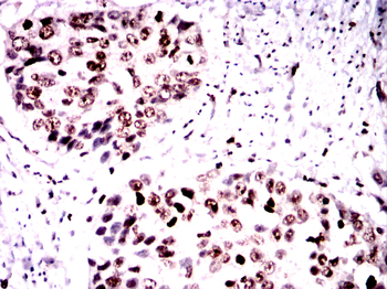 TERF2 Antibody