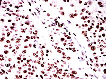 TERF2 Antibody