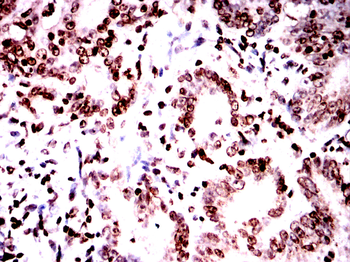 TERF2 Antibody