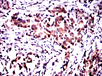GPNMB Antibody