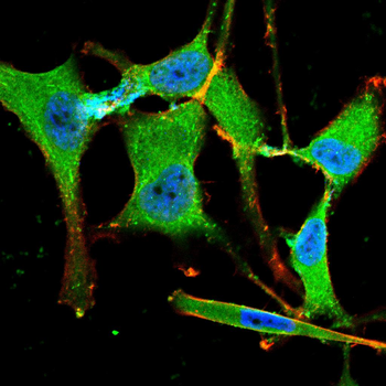 GPNMB Antibody