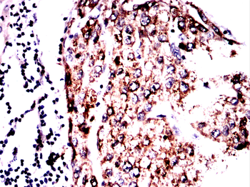 GPNMB Antibody