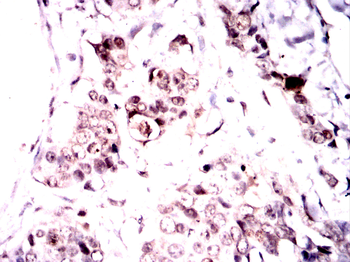 ONECUT3 Antibody