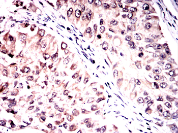 ONECUT3 Antibody