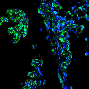 ONECUT3 Antibody