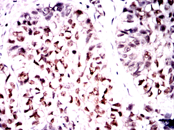 ONECUT3 Antibody