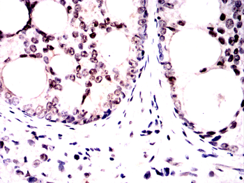 ONECUT3 Antibody