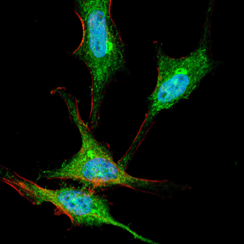 CD22 Antibody