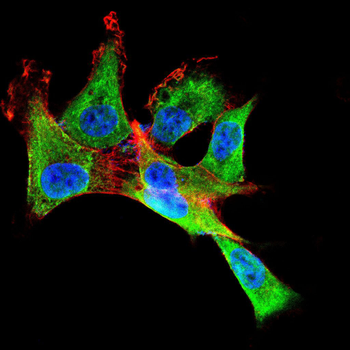 SYCP3 Antibody