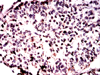 RING1 Antibody