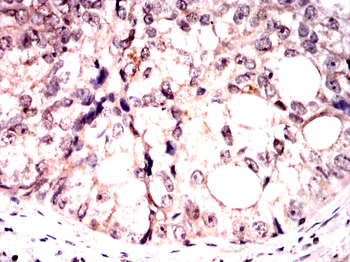 RING1 Antibody