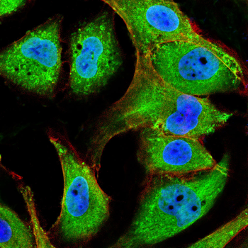 KLK3 Antibody
