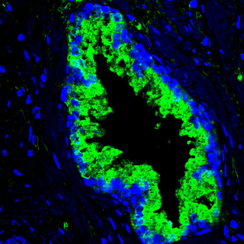KLK3 Antibody