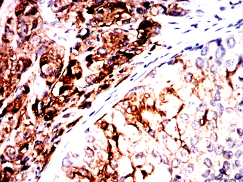 KLK3 Antibody