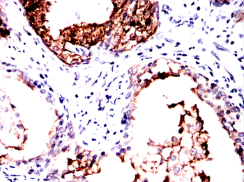 KLK3 Antibody