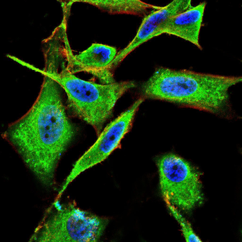 KLK3 Antibody
