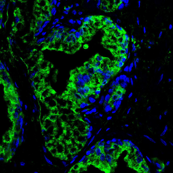 KLK3 Antibody