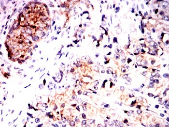KLK3 Antibody