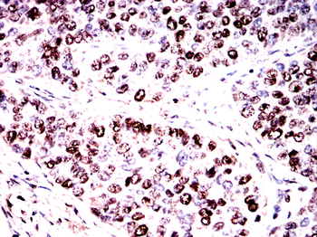 NBN Antibody