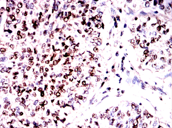 NBN Antibody