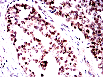 NBN Antibody