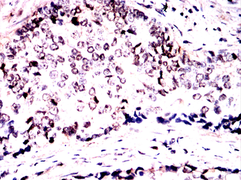 NBN Antibody
