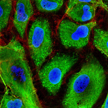 TIE1 Antibody